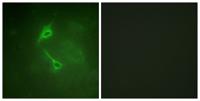 PKC ζ Polyclonal Antibody