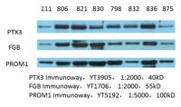 Ptx3 Polyclonal Antibody