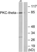 PKC θ Polyclonal Antibody