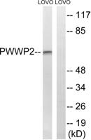 PWWP2B Polyclonal Antibody