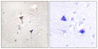 PKD1 Polyclonal Antibody