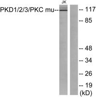 PKD1/2/3 Polyclonal Antibody