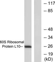 QM Polyclonal Antibody