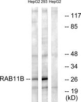 Rab 11B Polyclonal Antibody