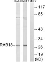 Rab 18 Polyclonal Antibody