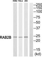 Rab 2B Polyclonal Antibody