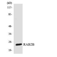 Rab 2B Polyclonal Antibody