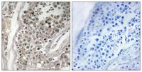 Rab 3 GAP p130 Polyclonal Antibody