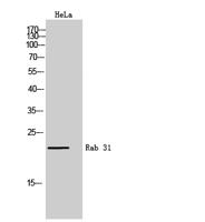 Rab 31 Polyclonal Antibody