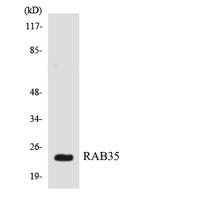 Rab 35 Polyclonal Antibody