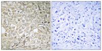 Rab 37 Polyclonal Antibody