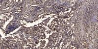 Rab 38 Polyclonal Antibody