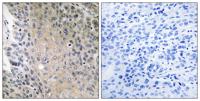 Rab 41 Polyclonal Antibody