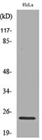 Rab 5A Polyclonal Antibody