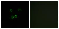 RGR Polyclonal Antibody