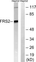 FRS2 Polyclonal Antibody