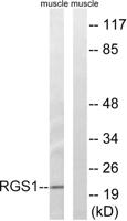 RGS1 Polyclonal Antibody