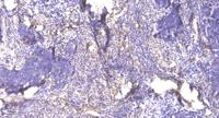 RGS14 Polyclonal Antibody