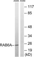 Rab 6A Polyclonal Antibody