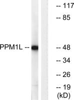 PP2Cε Polyclonal Antibody