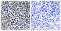 PP2Cκ Polyclonal Antibody