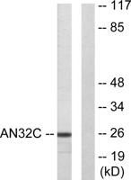 PP32R1 Polyclonal Antibody