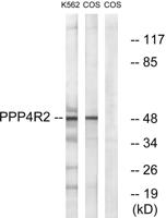 PP4R2 Polyclonal Antibody