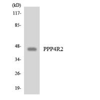 PP4R2 Polyclonal Antibody