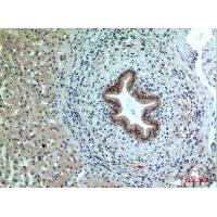 PPP1R15B Polyclonal Antibody
