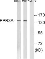 PPP1R3A Polyclonal Antibody