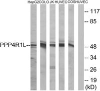 PPP4R1L Polyclonal Antibody