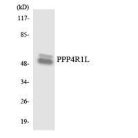 PPP4R1L Polyclonal Antibody