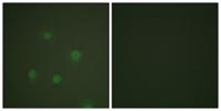 PR Polyclonal Antibody