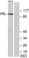 PR Polyclonal Antibody