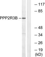 PR48 Polyclonal Antibody