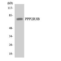 PR48 Polyclonal Antibody