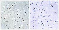 PRC Polyclonal Antibody