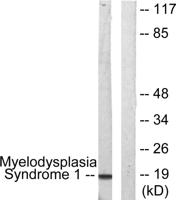 PRDM3 Polyclonal Antibody