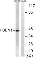 Presenilin 1 Polyclonal Antibody