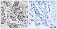 PRKX Polyclonal Antibody