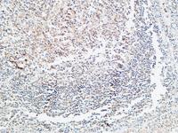 Prothrombin Polyclonal Antibody