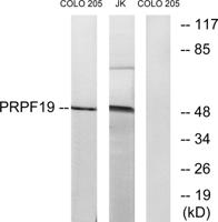 PRP19 Polyclonal Antibody