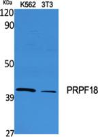 PRPF18 Polyclonal Antibody