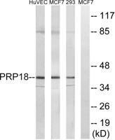 PRPF18 Polyclonal Antibody