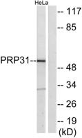 PRPF31 Polyclonal Antibody