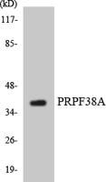 PRPF38A Polyclonal Antibody