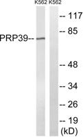 PRPF39 Polyclonal Antibody