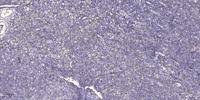 PRPF39 Polyclonal Antibody