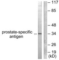 PSA Polyclonal Antibody