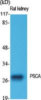 PSCA Polyclonal Antibody